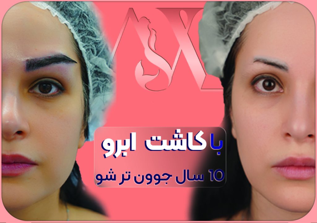 انتخاب رنگ مناسب ابرو قبل از میکرو کاشت